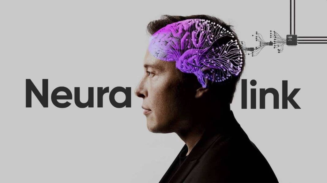 Elon Musk'un projesi Neuralink nedir? Neuralink ne işe yarayacak 17
